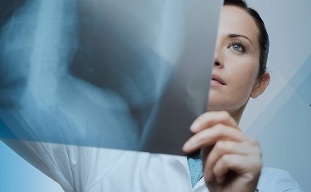 a nyaki osteochondrosis diagnosztikája